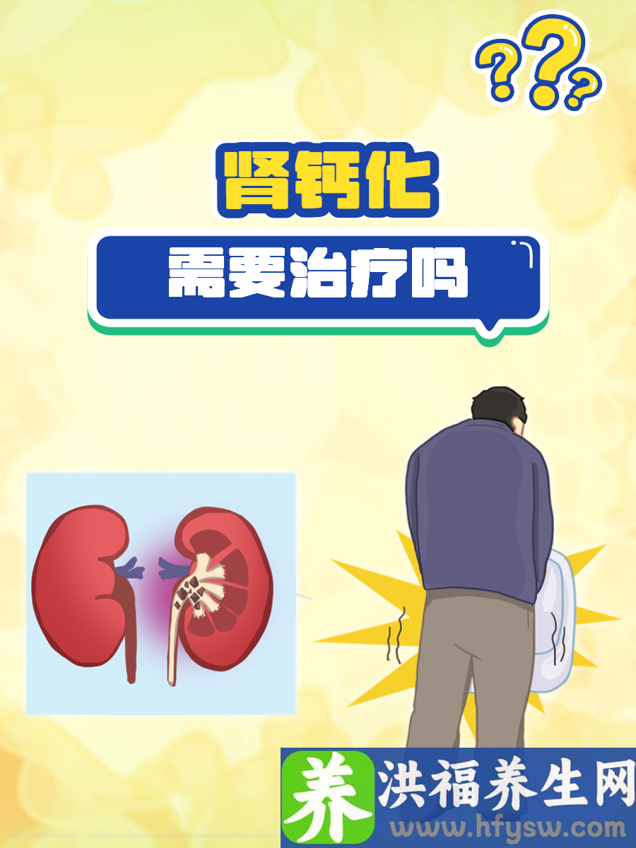肾钙化需要治疗吗？明确肾钙化的应对策略