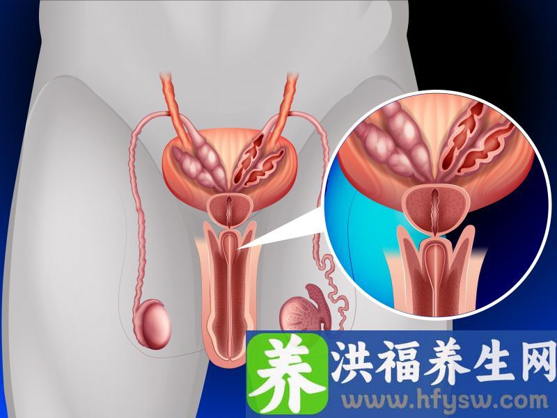 割包皮之后多久可以洗澡？注意这4个小细节，让你恢复得快