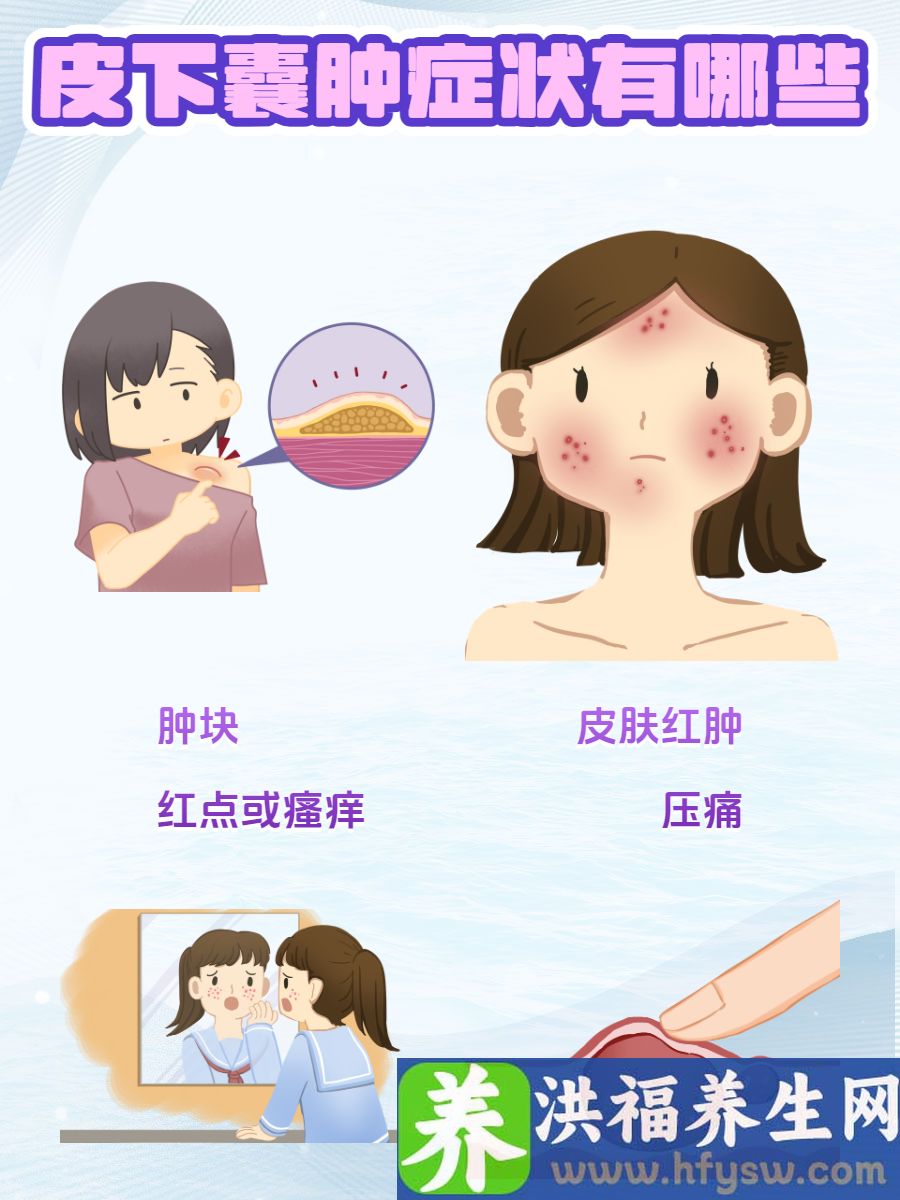 皮下囊肿症状有哪些？速来自查