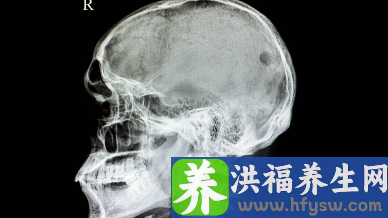 闭合性颅脑损伤轻型能治好吗