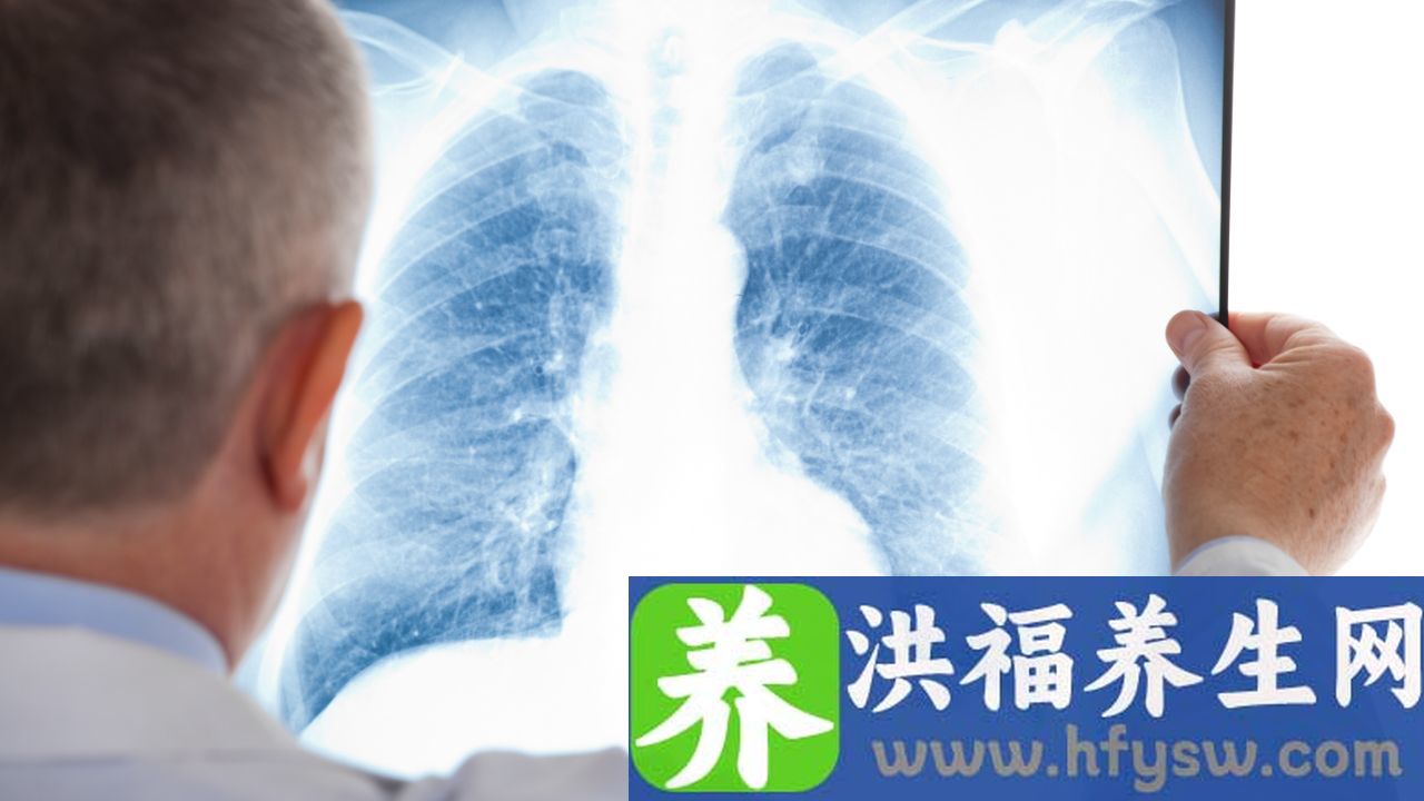 什么是肺炎衣原体肺炎