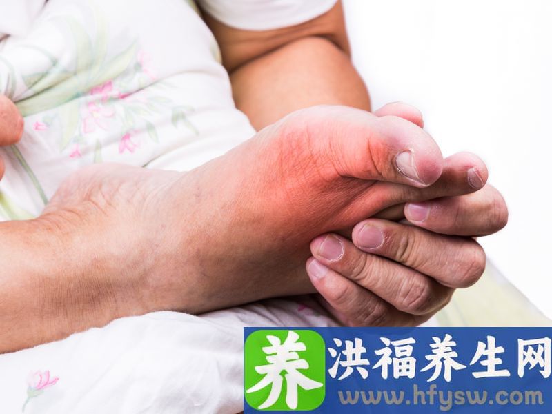 尿酸高究竟能吃什么？这5类食品虽好吃，但嘌呤含量很高，少碰点