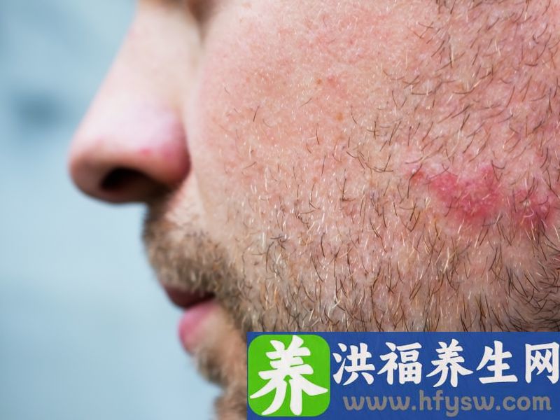 男性睾酮素水平降低，多半有4大异常，若你也有，需重视