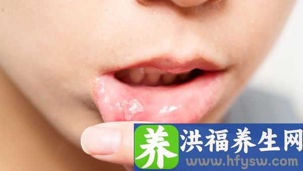 得白塞氏病严重吗