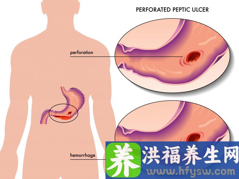 吃山药不但养胃，还能“补形”？常吃山药的人或能收获3大好处