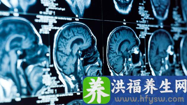 头部摔伤脑震荡后遗症