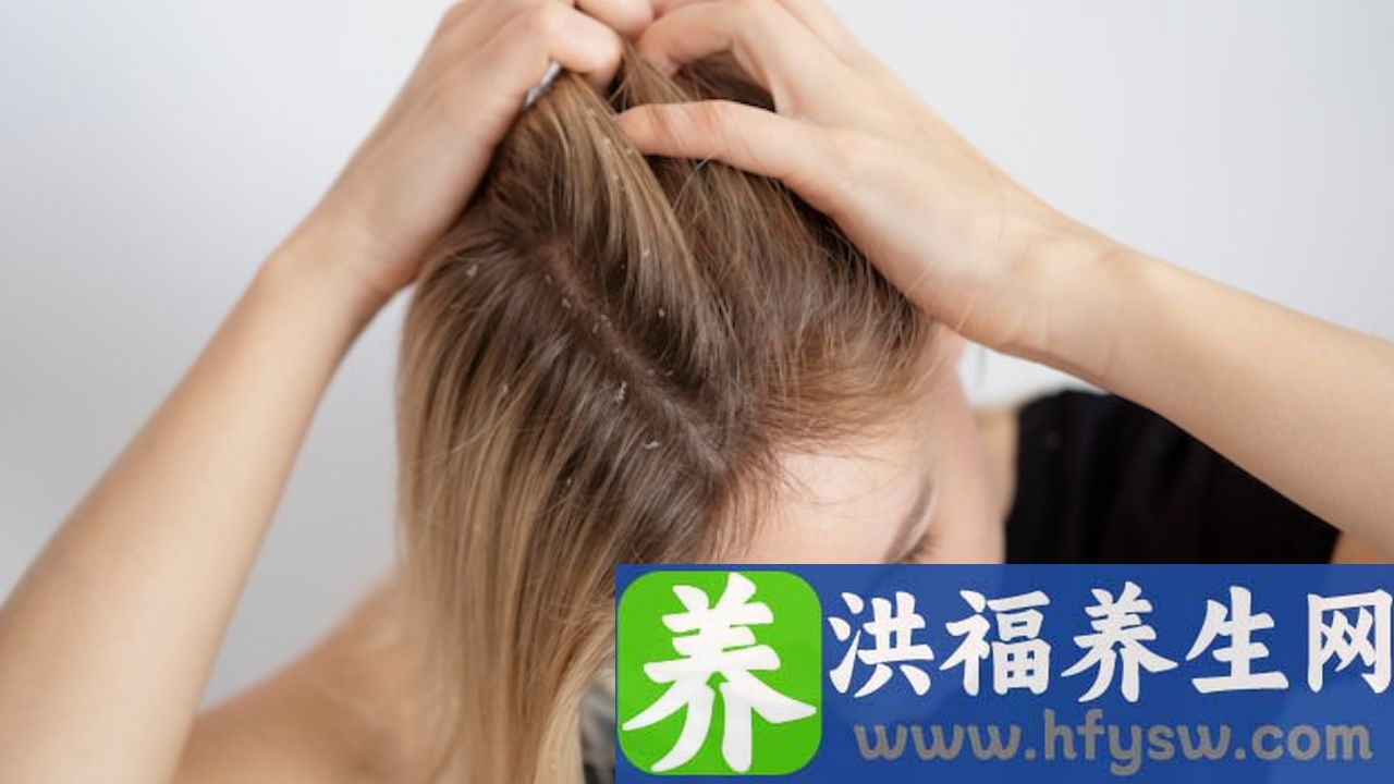 头皮痛是为什么