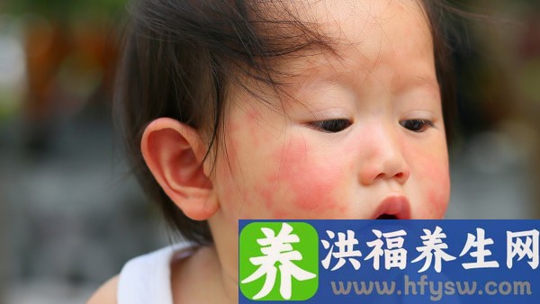 甲硝唑能治慢性前列腺炎
