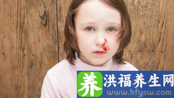 双黄连口服液与哪些药物不能一起服用 双黄连口服液可以治流鼻血吗