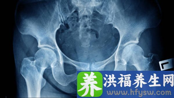 骨盆前倾睡觉不需要枕头的作用