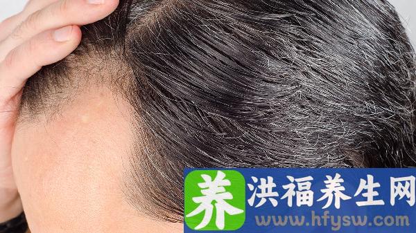 头皮血肿2个月了还没有吸收