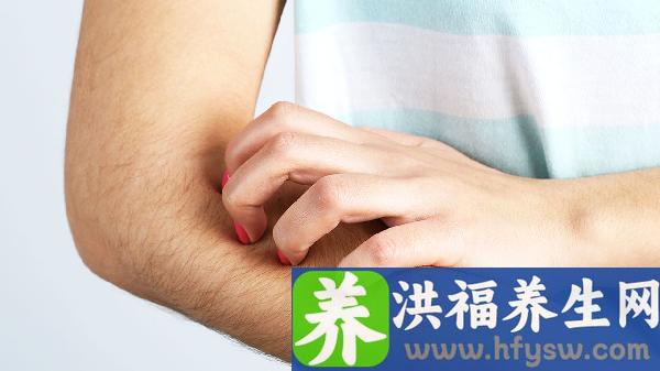 玻尿酸隆鼻后会导致皮肤过敏溃烂吗