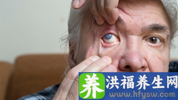 先天性白内障的后发障