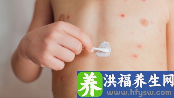 珍宝丸的作用是什么 珍宝丸是抗病毒的药吗