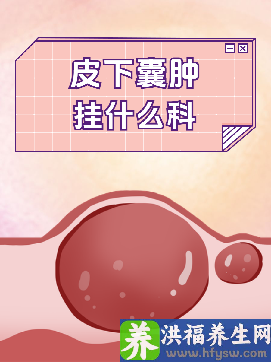 皮下囊肿挂什么科？正确了解就医科室