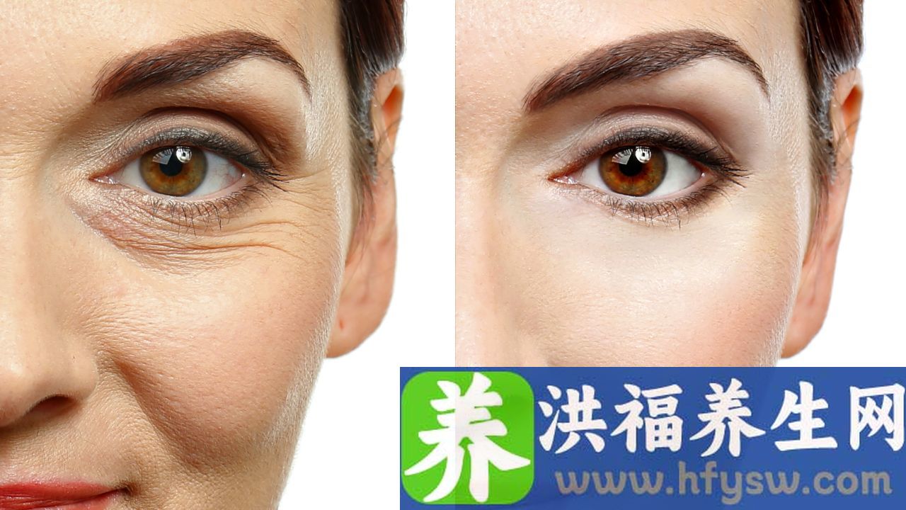 脸部肌肉痉挛是怎么回事
