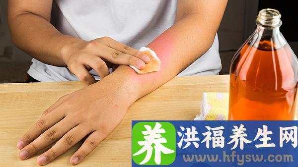 小儿包皮垢能用碘伏清洗吗