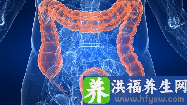 溃疡性结肠炎性关节炎治疗方案