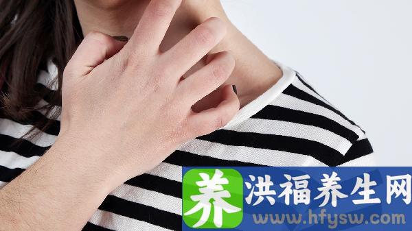 春季皮肤过敏困扰？7款食谱帮你轻松应对，远离过敏烦恼！