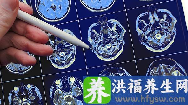 颅骨骨转移的早期症状