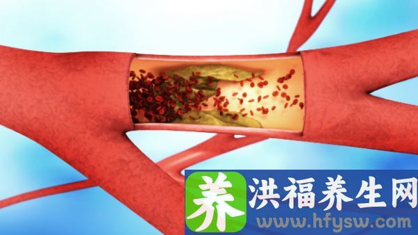 血脂稠怎么办
