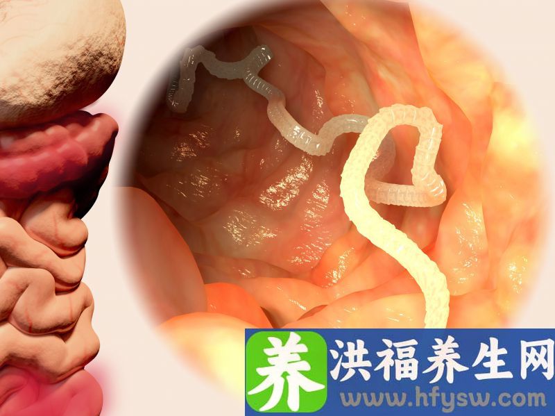 长期便秘，可能是和3类食物有关？要让肠道通畅，麻烦少吃点