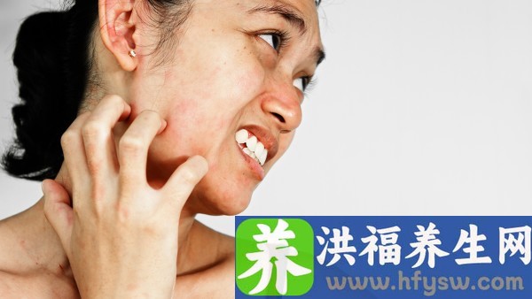 阴囊湿疹跟病毒性疱疹