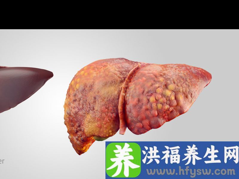 建议：3种食物餐桌常见，吃多了，或对肝脏产生伤害