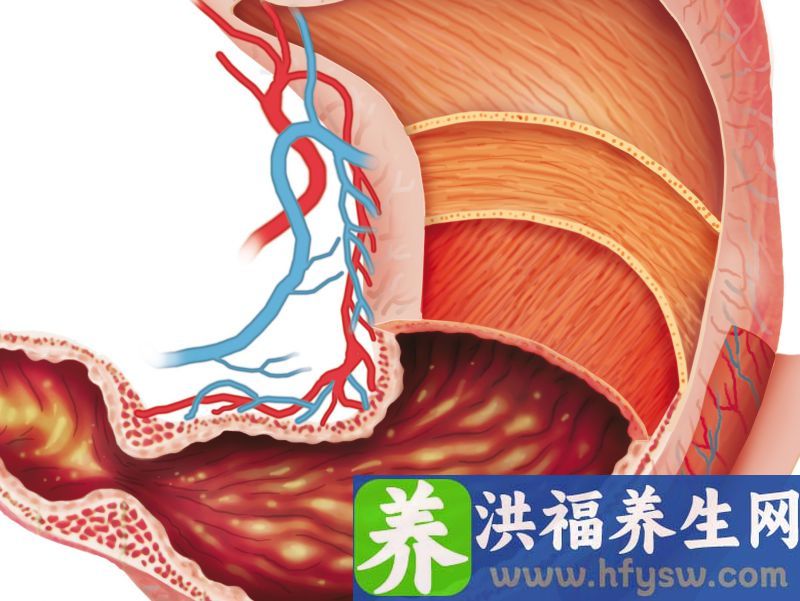 十人中九人有胃病，想养胃，这3种食物都得撤离餐桌