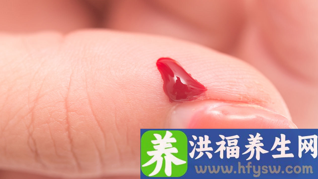 血脂标准范围是多少