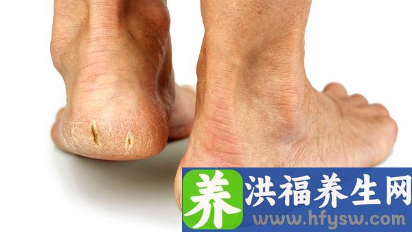 脚跟酸疼是怎么回事