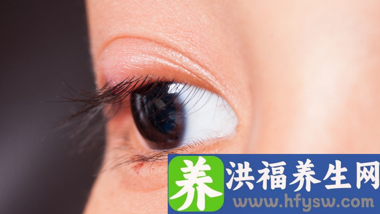 甲亢突眼怎样快速恢复