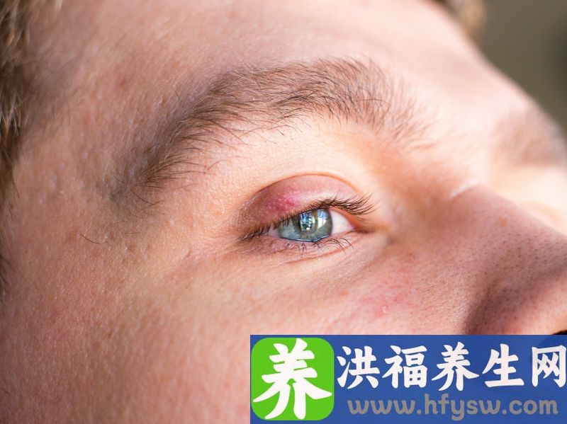 拒绝“熊猫眼”，4招教你缓解黑眼圈，不妨试试