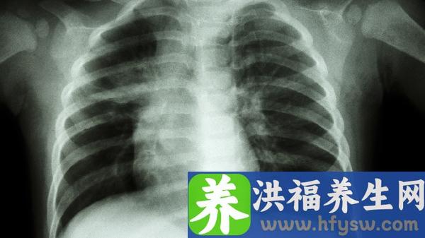 鸡胸肉怎么吃减肥效果好吃