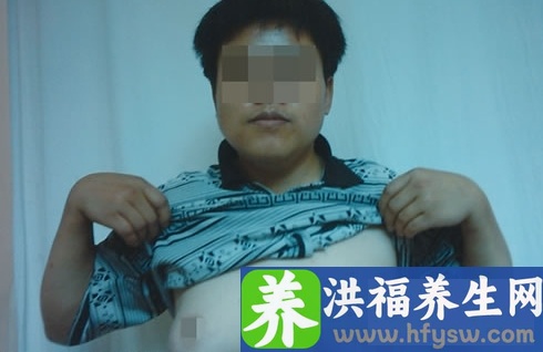 夏季养生食谱有哪些 五款美食清热消暑