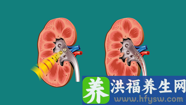 正常人什么原因会导致肌酐偏高