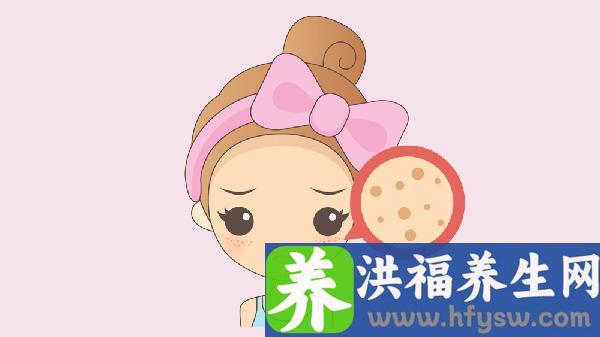 女性朋友养颜祛斑有哪些方法