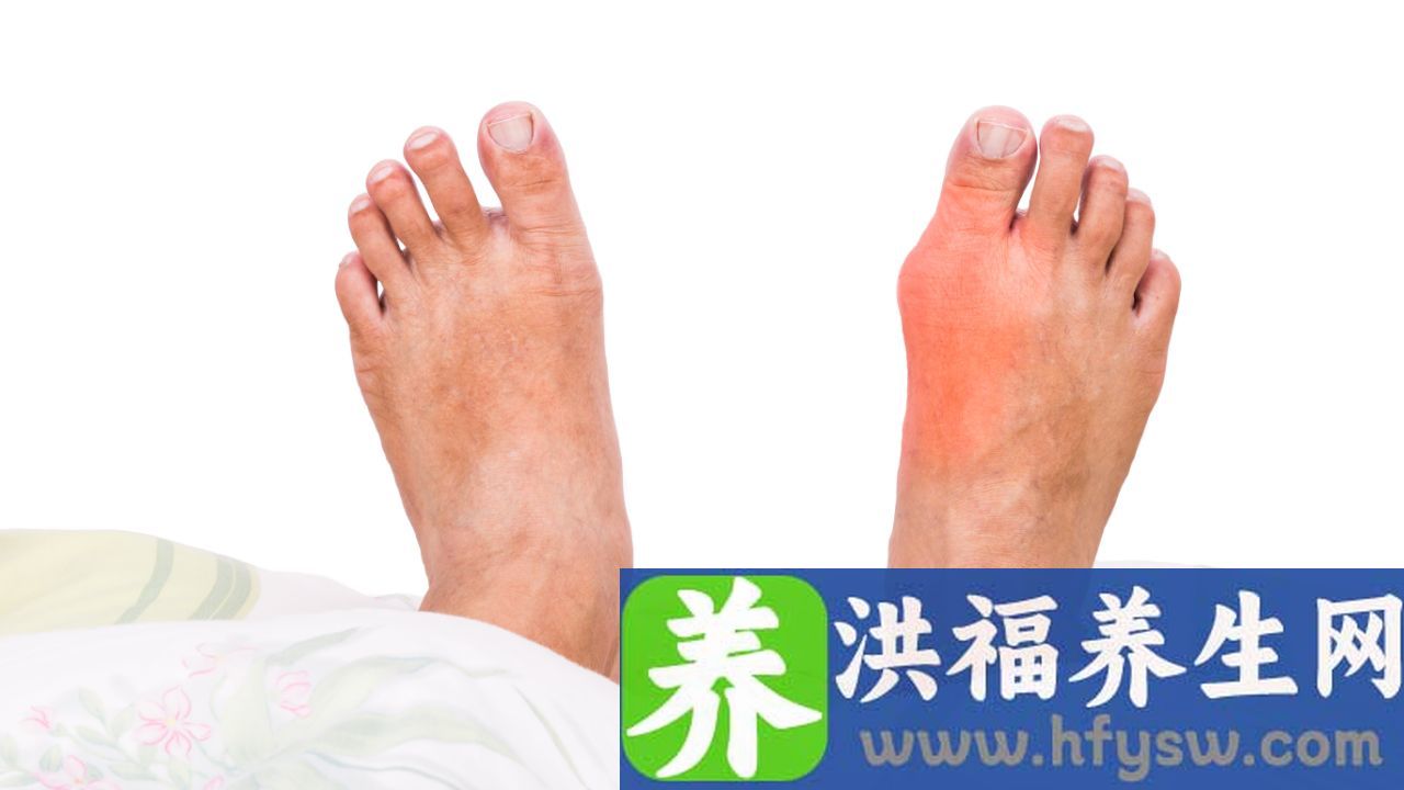 右脚发麻是怎么回事