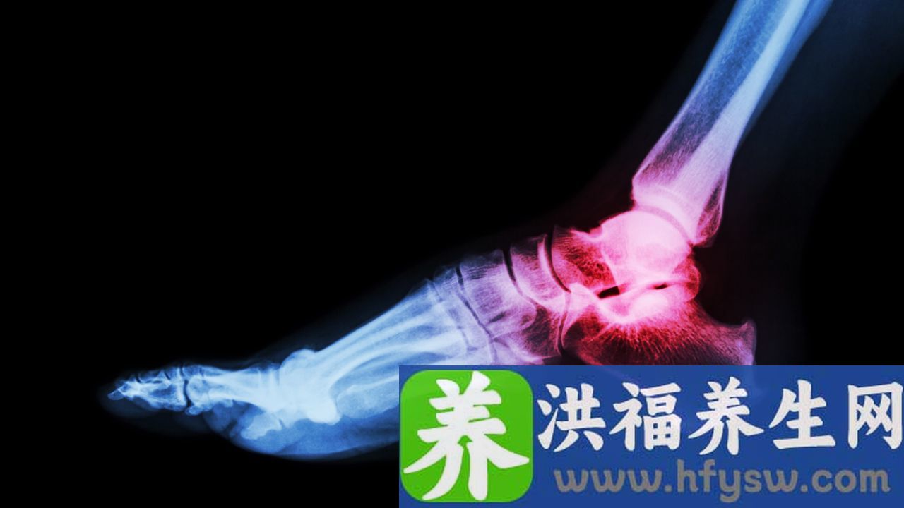 类风湿炎症有哪些症状