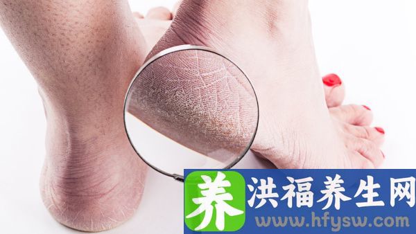 脚背皮肤薄怎么了