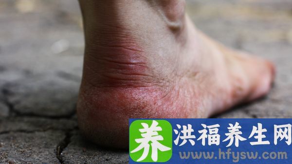 走路脚跟痛是什么原因
