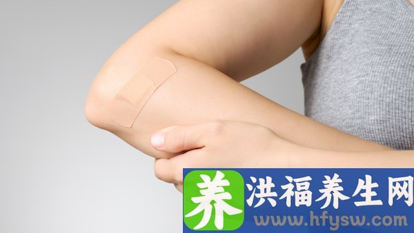 假性尖锐湿疣通常会自己消失吗