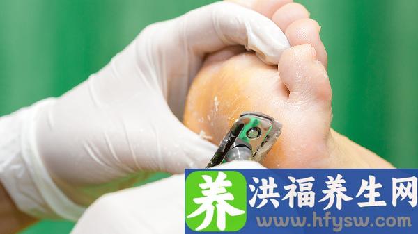 八岁扁平足可以矫正过来吗