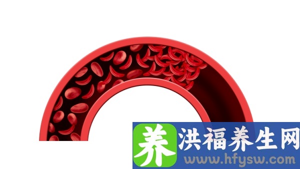怎么预防冠状动脉痉挛