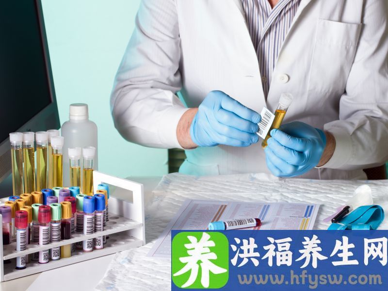 尿微量白蛋白150高吗