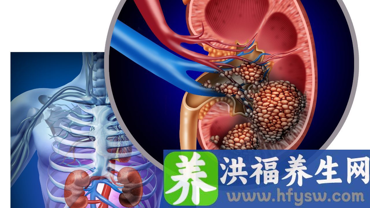 尿白细胞 -cell/ul怎么了