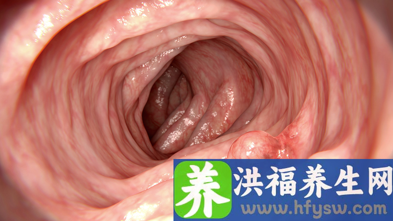 女性不孕有哪些检查项目？女性不孕如何进行腹腔镜检查？