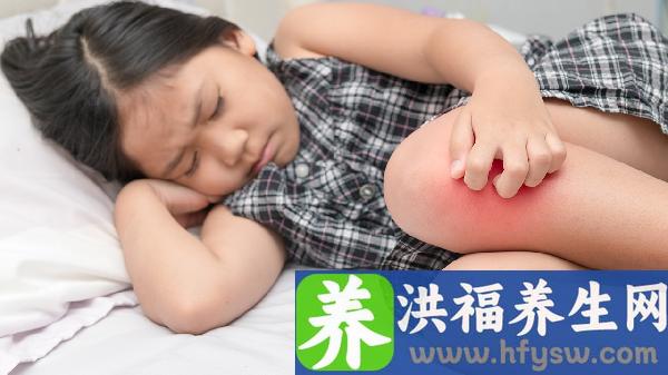 类风湿的中医治疗