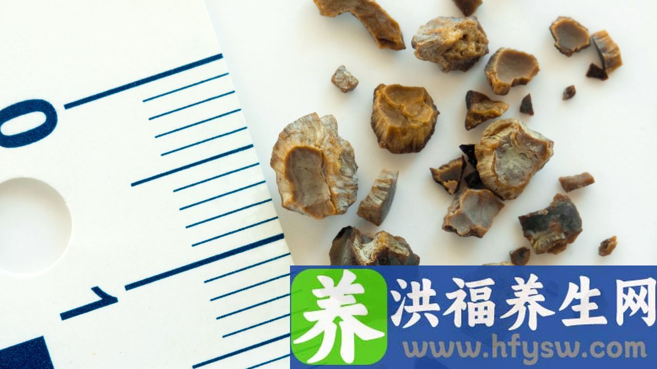肾结石痛怎么快10分钟止痛