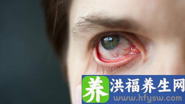 做眼睑外翻矫正费用大概需要多少